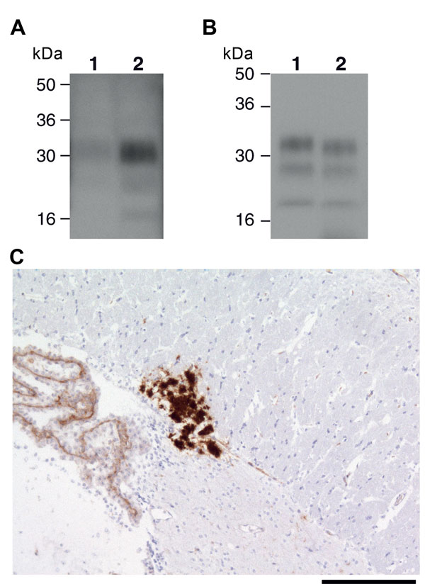Ovine bovine spongiform encephalopathy (BSE) prion transmission to a 129MMTg35c mouse. Panel A shows immunoblot detection of disease-related prion protein (PrPSc) in 10 μL of proteinase K (PK)–digested 10% (w/v) brain homogenates from ovine BSE (SE 1929/0877) (lane 1) and secondary passage ovine BSE (SE1945/0032) (lane 2) using  monoclonal antibody ICSM35 against prion protein (PrP). Panel B shows type 4 PrPSc in 1 μL of PK-digested 10% (w/v) vCJD brain homogenate (lane 1) in comparison to PrPSc