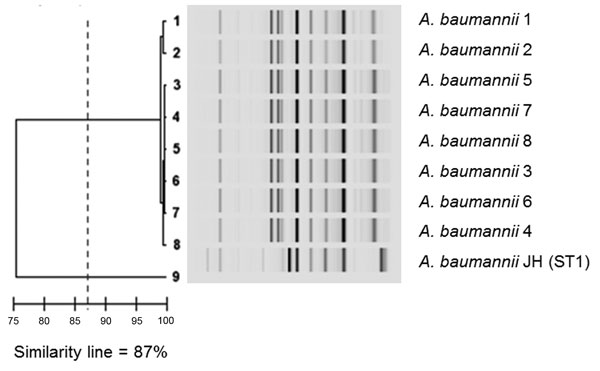 Results of Diversilab system (bioMérieux, La Balme-les-Grottes, France) analysis of Acinetobacter baumannii isolates. Similarity line shows the cutoff that separates the different clones.