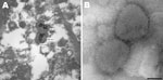 Thumbnail of A) Electron micrograph of poxvirus particles in synovium of a big brown bat, northwestern United States. B) Negative staining of poxvirus particles in cell culture supernatant. Scale bar = 100 nm.