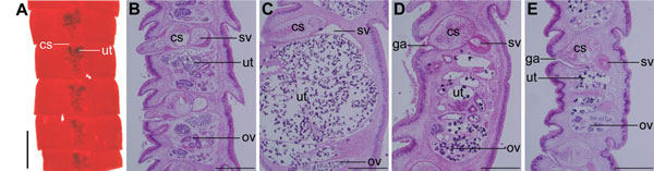 Diphyllobothriid samples examined in the present study, China, 2008–2012. A) Proglottids stained with acetic acid–carmine from case-patient 12. B–E) Sagittal sections of proglottids stained with hematoxylin-eosin from case-patients 16–19. cs, cirrus sac; ut, uterus; sv, seminal vesicle; ov, ovary; ga, genital atrium. Scale bar in panel A represents 2 mm; scale bars in panels B–E represent 500 μm.