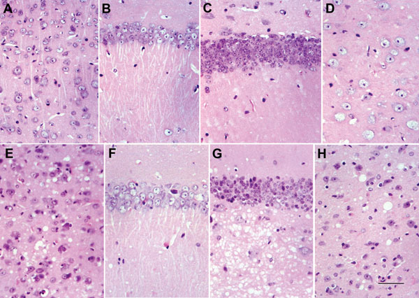 Comparison between homozygous bovine prion protein (BoPrP)-Tg110+/+ control mice (panels A–D) and hemizygous 113LBoPrP-Tg037+/− mice with end-stage disease (panels E–H) in parietal cortex (panels A and E), CA1 region of the hipocampus (panels B and F), dentate gyrus (panels C and G), and medial thalamus (panels D and H). Severe spongiosis is seen in the cerebral cortex, hilus ofdentate gyrus, and medial thalamus, but not in the CA1 area of the hippocampus and granule cell layer of the dentate gy