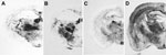 Thumbnail of Immunochemical analysis of paraffin-embedded tissue blots of representative coronal sections of the hippocampus, showing deposition patterns of abnormal isoform of host-encoded prion protein in brains from BoPrP-Tg110 mice infected with bovine spongiform encephalopathy (BSE)-C (A), 113L-BSE (B), BSE-H (C), and BSE-L (D) prions. BoPrP, bovine prion protein; 113L, leucine substitution at codon 113. Monoclonal antibody Sha31 stained by using the procedure of Andréoletti et al. (29). Or