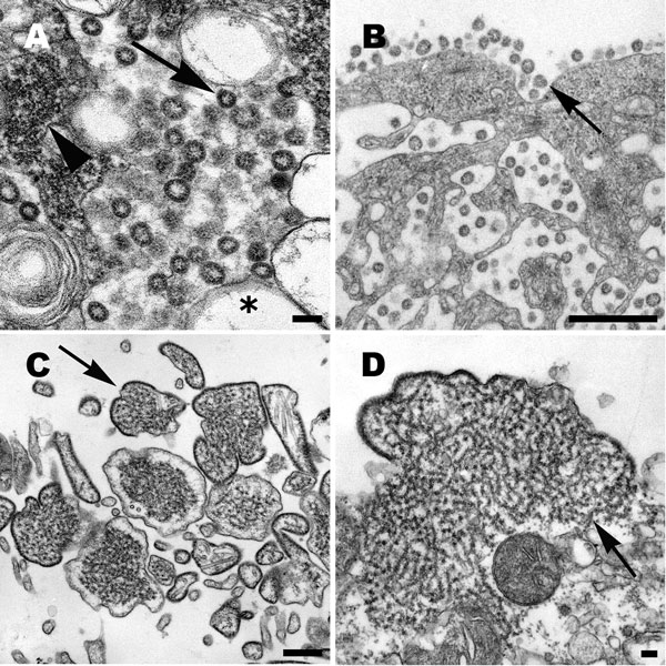 A) Cell culture isolate of severe acute respiratory syndrome coronavirus, in which virions are seen in the cisternae of the budding compartment (arrow). Also present are an inclusion of viral nucleocapsids (arrowhead) and double-membrane vesicles (asterisk). Scale bar = 100 nm. B) Coronavirus particles in cytoplasmic vesicles that appear to migrate to the cell surface. Virions are seen lining the cell membrane (arrow), a characteristic feature of this virus. Scale bar = 500 nm. C) Large, pleomor