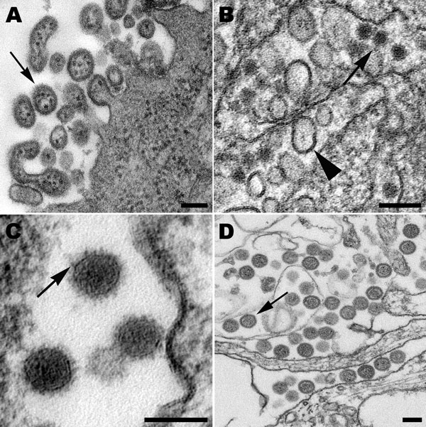 A) Extracellular lymphocytic choriomeningitis virus particles (arrow) containing cellular ribosomes. B) West Nile virus particles (arrow) in the lumen of the rough endoplasmic reticulum of an infected cell. Also in the cisternae are smooth membrane vesicles (arrowhead). C) High magnification of Cache Valley virus particles within a Golgi vesicle, showing small surface projections (arrow). D) Extracellular, spherical Homeland virus particles (arrow) with a slightly granular core. Scale bars = 100