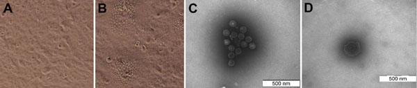 Cytopathic effect and morphology of pseudorabies virus strain HeN1. A) Uninfected control Vero cells. B) Pseudorabies virus–infected Vero cells. A) and B) Original magnification ×200. The cytopathic effect, which was characterized by reticulated cells, was observed 48 h after inoculation. Spherical virus particles without (C) or with (D) viral envelope were observed by electron microscopy.