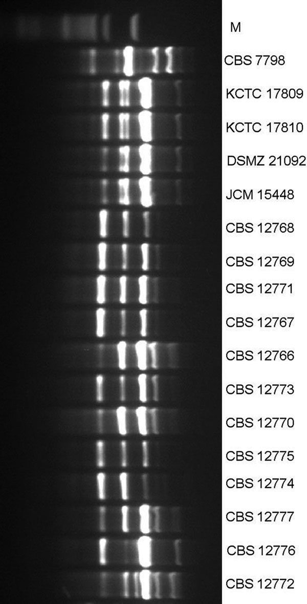 M13 PCR fingerprinting of Candida auris isolates. Lane 1, 50-bp ladder (New England BioLabs, Evry, France); lane 2, C. duobushaemulonii reference isolate (CBS7798); lanes 3–6, C. auris isolates from South Korea (KCTC 17809 and KCTC 17810), Japan (DSMZ21092 and JCM 15448), and reference isolates; and lane 7–18, 12 test isolates from India.