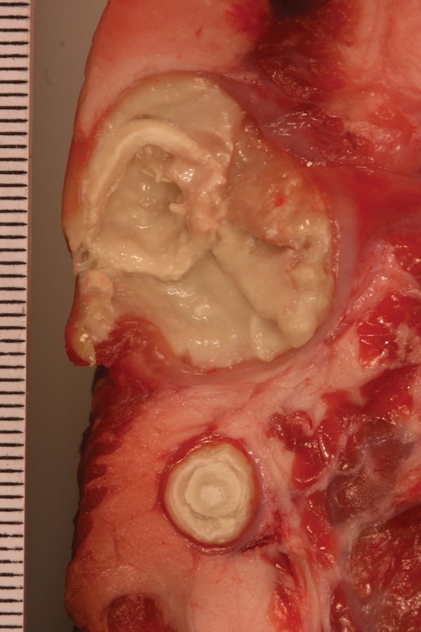 Pseudotuberculosis-like caseous abscesses caused by Corynebacterium ulcerans in wild boar S28/3/13.
