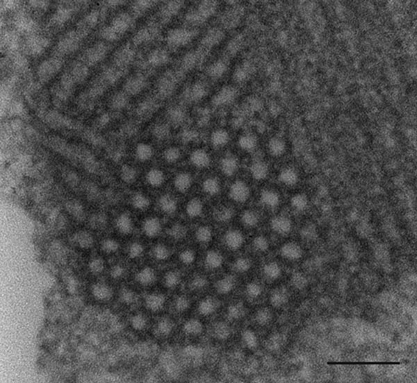 Transmission electron microscopic image of necrotic neuron in the lumbar region of a heifer with encephalomyelitis. Intracytoplasmic paracrystalline array of 27–28-nm diameter viral-like particles. Scale bar indicates 100 nm.