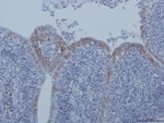Thumbnail of Replication of guinea fowl coronavirus in intestinal epithelium cells of experimentally infected birds as evidenced by immunohistochemical testing with a turkey coronavirus–specific monoclonal antibody, France, 2010–2011 (9).