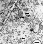 Thumbnail of Transmission electron microscopy image of Vero cells infected with severe fever with thrombocytopenia syndrome virus (arrows). Scale bar indicates 500 nm.