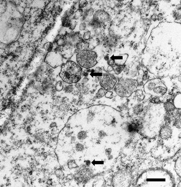 Transmission electron microscopy image of Vero cells infected with severe fever with thrombocytopenia syndrome virus (arrows). Scale bar indicates 500 nm.