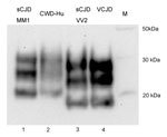Thumbnail of PrPres typing of the CWD amplification product. The CWD PMCA product derived from amplification in a human brain homogenate substrate (PRNP codon 129MM) was compared by Western blotting with PrPres from human brain samples from cases of sCJD of the MM1 subtype, sCJD of the VV2 subtype, and variant CJD. The PrP detection antibody was 3F4. PrPres, protease-resistant prion protein; CWD, chronic wasting disease; PMCA, protein misfolding cyclic amplification; sCJD sporadic Creutzfeldt-Ja