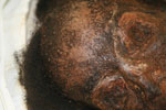 Thumbnail of Mummified remains of a woman buried in an iron coffin, New York, New York, USA, mid-1800s. Photograph provided by Don Weiss.