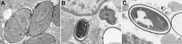 Electron micrographs of muscle biopsy tissue from a 66-year-old man (case-patient B) (A) and a 67-year-old man (case-patient A) (B,C) showing Anncaliia algerae. A) Early proliferative stage meronts with diplokaryotic nuclei (n) and vesiculotubular appendages (arrows) attached to the plasmalemma. Scale bar indicates 1 μm. B) Degenerate crenated sporoblast (sb) and a mature spore with visible coils of the polar tubule (arrows). Scale bar indicates 1 μm. C) Mature spore with 9 polar tubule coils in