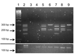 Thumbnail of Amplification of bovine leukemia virus (BLV) genome regions in human breast tissue specimens. Nested liquid-phase PCR, using primers from 5 BLV genome regions, was used to amplify products from DNA extracted from breast tissues of 6 human donors. PCR products for each tissue were loaded into 1 well and separated by agarose gel (3.5%) electrophoresis on the basis of size differences: long terminal repeat, 290 bp; group-specific antigen, 272 bp; envelope, 230 bp; trans-activating gene