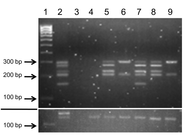 Amplification of bovine leukemia virus (BLV) genome regions in human breast tissue specimens. Nested liquid-phase PCR, using primers from 5 BLV genome regions, was used to amplify products from DNA extracted from breast tissues of 6 human donors. PCR products for each tissue were loaded into 1 well and separated by agarose gel (3.5%) electrophoresis on the basis of size differences: long terminal repeat, 290 bp; group-specific antigen, 272 bp; envelope, 230 bp; trans-activating gene of the X reg