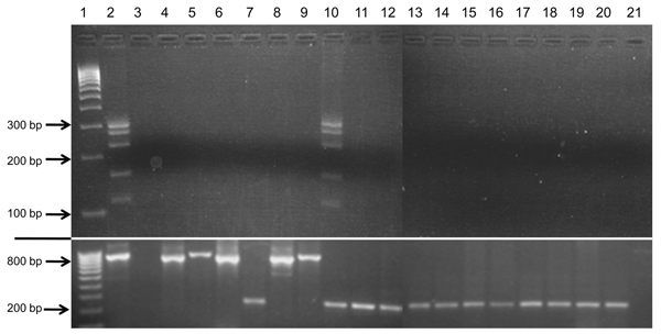 Test results showing lack of cross-reactivity of bovine leukemia virus (BLV)–specific primers with representatives of all mammalian and avian retrovirus subfamilies and human exogenous and endogenous viruses previously identified in human breast tissue. Nested liquid-phase PCR used primers from 5 BLV genome regions with template DNA from the viruses in lanes 4–10 and 12–21. PCR products for each virus, loaded into 1 well, were separated by agarose gel (1.5%) electrophoresis on the basis of size 
