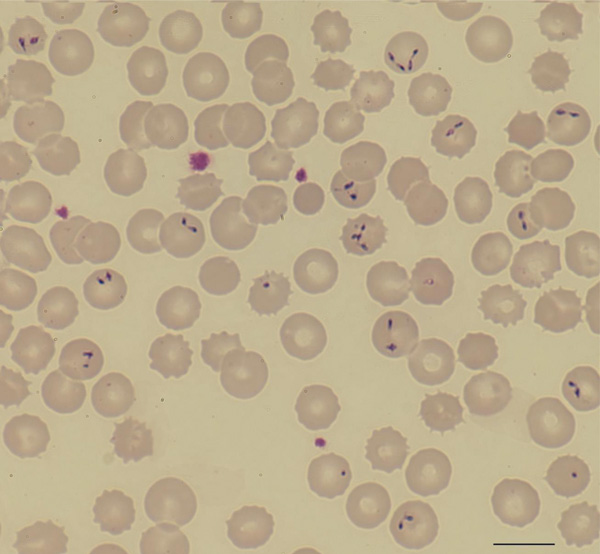 Photomicrography of a Giemsa-stained thin film of a 46-year-old man showing Babesia divergens. Double pear-shaped intraerythrocytic parasites are indicated by arrows. Slides were examined with a Nikon microscope at 60× magnification. Scale bar indicates 500 nm.