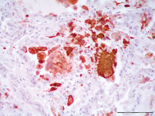 Lung from necropsy of a bottlenose dolphin (Tursiops truncatus) that had fatal systemic morbillivirus infection, Canary Islands, Spain, 2005. Positive intracytoplasmic and intranuclear immunoperoxidase staining of morbilliviral antigen (red) within hyperplastic type II pneumocytes, macrophages and multinucleated syncytial cells. Avidin-biotin-peroxidase with Harris hematoxylin counterstain. Scale bar = 100 μm.