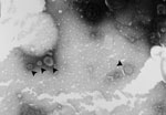 Thumbnail of Negative-staining electron micrograph image showing influenza A(H1N1)pdm09 virus particles (arrowheads) in allantoic fluid supernatant collected from specific pathogen free eggs after injection with a nasal swab sample collected from a giant panda in China. Original magnification ×40,000.
