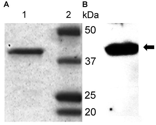 Polyacrylamide gel electrophoresis purification (A) and Western blot analysis (B) of recombinant glycerophosphodiester phosphodiesterase (rGlpQ). A) Coomassie blue staining of purified Borrelia miyamotoi sensu lato rGlpQ (lane 1) and of Precision Plus Protein Prestained Standards (Bio-Rad, Laboratories, Hercules, CA, USA) (lane 2). B) Western blot analysis of B. miyamotoi sensu lato–positive control mouse serum shows 39-kDa rGlpQ-specific band (arrow).