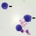 Thumbnail of Light micrograph of Anaplasma phagocytophilum cultured in human promyelocytic cell line HL-60, showing A. phagocytophilum morulae as basophilic and intracytoplasmic inclusions (arrows). Wright–Giemsa stain, original magnification x1,000. 