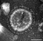 Thumbnail of Electron micrograph of a US porcine epidemic diarrhea virus (PEDV) particle detected in a field fecal sample collected during a 2013 outbreak of PED on a farm in Ohio, USA; the fecal sample from which PEDV strain PC21A in this study was detected was from a pig on the same farm during the same outbreak. The sample was negatively stained with 3% phosphotungstic acid. Scale bar = 50 nm.