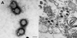 Thumbnail of Electron microscopic examination results of a newly isolated virus, tentatively named Hunter Island Group virus, isolated from ticks collected from shy albatrosses, Tasmania, Australia. A) Negative-contrast staining of virions. B) Thin section of infected Vero cells showing the presence of viral particles. Original magnification ×100,000; scale bars represent 100 nm, 