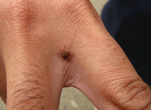 An adult male Amblyomma aureolatum tick attached to the hand of a person who became infested while in direct contact with a naturally infested dog in the metropolitan area of São Paulo, Brazil.
