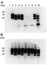 Thumbnail of Western blot analysis of protease-resistant isoforms of PrP (PrPres) in extracts of frontal cortex tissue prepared from postmortem samples from 4 persons with sCJD and from 3 persons with VPSPr whose brain samples were used for experimental transmission studies in transgenic mice. Results are shown for extracts treated (A) and not treated (B) with proteinase K. All lanes were loaded with 5.0 μL of 10% (wt/vol) brain homogenate, except lanes 9 and 10 in (A), which were loaded with 1.