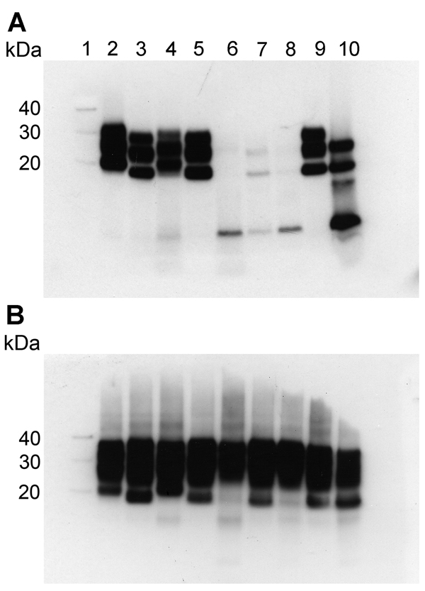Western blot analysis of protease-resistant isoforms of PrP (PrPres) in extracts of frontal cortex tissue prepared from postmortem samples from 4 persons with sCJD and from 3 persons with VPSPr whose brain samples were used for experimental transmission studies in transgenic mice. Results are shown for extracts treated (A) and not treated (B) with proteinase K. All lanes were loaded with 5.0 μL of 10% (wt/vol) brain homogenate, except lanes 9 and 10 in (A), which were loaded with 1.5 μL and 20.0