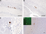 Thumbnail of Neuropathology in transgenic mice following inoculation with brain homogenate prepared from a postmortem sample from a person with VPSPr. Numerous PrP-labeled plaque-like deposits within the corpus callosum of HuVV (A) and HuMV (B) mice inoculated with brain homogenate from patient UK-VV. C) A single small PrP-labeled plaque in the stratum oriens of the hippocampus following experimental challenge with brain homogenate from patient NL-VV. D) PrP-labeled plaque-like-deposits in the c