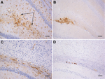 Thumbnail of Gliosis in transgenic mice following inoculation with brain homogenate prepared from a postmortem sample from a person with variably protease-sensitive prionopathy. A) Immunohistochemical staining for GFAP in the hippocampus of a HuVV mouse showing microplaque-like deposits. Arrows indicate areas of reactive astrocytosis. B) A serial section from the same HuVV mouse immunolabeled for PrP by using monoclonal antibody (Purified [3F4], Cambridge Bioscience, Cambridge, UK). C) Immunohis