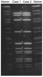 Thumbnail of Pulsed-field gel electrophoresis (PFGE) patterns for N. meningitidis strains isolated from a man with urethritis (case 1) and his male sex partner (case 2), Japan. PFGE was performed with the restriction enzyme NheI. Results showed the same PFGE pattern for both isolates. Salmonella enterica serovar Braenderup strain H9812 was used as the PFGE size marker strain; it was digested with Xbal and resolved by PFGE.