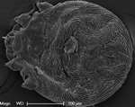 Thumbnail of Electron microscopic image of mite, showing features consistent with Knemidocoptes derooi mites. 