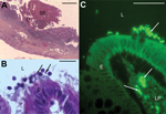 Thumbnail of Micrographs showing histopathologic examination of appendix samples from a child who had peritonitis, Casablanca, Morocco, 2013. A) Ulceration (U) covered with suppurative and fibrinous exudates (SE) (hematoxylin-eosin stain). Scale bar indicates 200μm. B) Blastocystis parasites (arrows) in the lumen (L), and at the surface of the epithelium (E) (hematoxylin-eosin stain). Scale bar indicates 20μm. C) Blastocystis parasites (arrows) in the lumen, at the surface of the epithelium and 