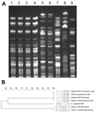 Thumbnail of Pulsed-field gel electrophoresis (PFGE) analysis of samples from patients in Hong Kong showing 3 Elizabethkingia anophelis strains compared with reference Elizabethkingia isolates. A) PFGE performed by using CHEF Mapper XA system (Bio-Rad, Hercules, CA, USA) and restriction endonuclease XbaI shows that isolates from patient 2 and patient 3 are indistinguishable, wheras isolates from patient 1 possess distinct PFGE patterns. Lane 1, E. anophelis strain HKU37 from uterine swab specime