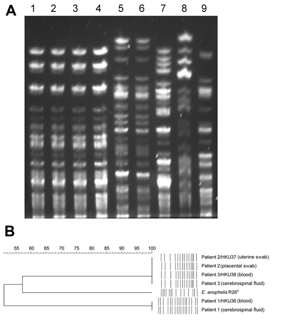 Pulsed-field gel electrophoresis (PFGE) analysis of samples from patients in Hong Kong showing 3 Elizabethkingia anophelis strains compared with reference Elizabethkingia isolates. A) PFGE performed by using CHEF Mapper XA system (Bio-Rad, Hercules, CA, USA) and restriction endonuclease XbaI shows that isolates from patient 2 and patient 3 are indistinguishable, wheras isolates from patient 1 possess distinct PFGE patterns. Lane 1, E. anophelis strain HKU37 from uterine swab specimen of patient 