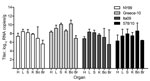 Thumbnail of Viral RNA copy numbers in organs from 22 carrion crows euthanized because of illness after being experimentally infected with 1 of 4 different West Nile virus strains (n = 6, per group). Copy numbers are represented as log-transformed medians; error bars indicate range. The assay had a detection limit of 9 (1.0 log10) RNA copies/g of tissue. H, heart; L, liver; S, spleen; K, kidney; Bo, bone marrow; Br, brain.