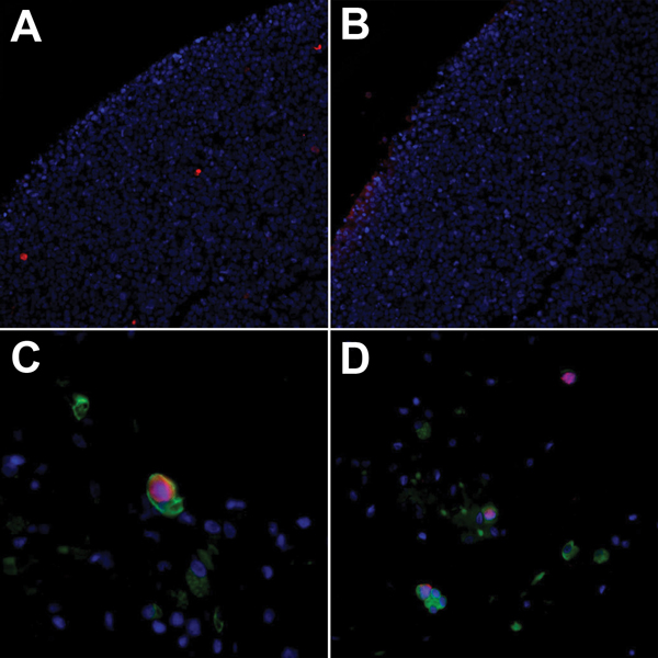 WU polyomavirus antigen in respiratory epithelial cells from lungs transplanted into a recipient (28-year-old woman) with Job syndrome. Immunofluorescence of 293T cells transfected with pDEST26-WU–virus protein 1 and stained with A) WU virus protein 1 polyclonal antibody (NN-Ab01) or B) preimmune serum. C) Double immunofluorescence with NN-Ab01 (red) and a monoclonal antibody against cytokeratin (green) showing a double-positive cell from the bronchoalveolar lavage specimen. D) Bronchoalveolar l
