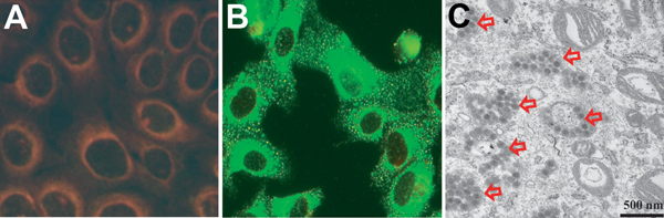 Isolation of severe fever with thrombocytopenia syndrome virus (SFTSV) from case-patients, South Korea, 2013. A, B) Indirect immunofluorescent features of Vero E6 cells primed with SFTSV N protein monoclonal antibody and reacted with fluoresce in isothiocyanateconjugated anti-mouse IgG. B) Transmission electron microscopy image of Vero E6 cells infected with SFTSV. Scale bar indicates 500 nm.