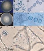 Thumbnail of Morphologic features of isolates of Lagenidium giganteum mosquito control agent and L. giganteum mold from mammals. A) Phenotypic features in culture of the mammalian pathogen (ATCCMYA-4933, type strain) and (D) the biological control (ATCC 36492). The development of spherical and ovoid 40- to 170-μm swelling segments (B, C, E, F) was the main feature of both mammalian and biocontrol strains. (G) A tubular body developed from an unseen segmented sporangium form a vesicle enclosing n