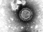 Thumbnail of Porcine epidemic diarrhea virus particles seen by negative-stain electron microscopy of fecal samples. Negative staining with 1% phosphotungstic acid. Scale bar indicates 100 nm.