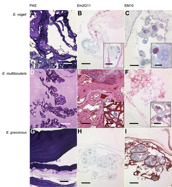 Figure - Echinococcus vogeli in Immigrant from Suriname to the ...