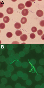 Thumbnail of A) Spirochetes in blood smear of a 55-year-old man with tickborne relapsing fever, Bitterroot Valley, Montana, USA (Giemsa stain). Erythrocyte diameters are ≈6–8 µm. B) Spirochetes in blood smear of the patient visualized by indirect immunofluorescent antibody staining with mouse monoclonal antibody H9724 and goat anti-mouse antibody conjugated with fluorescein isothiocyanate (original magnification ×1,000).