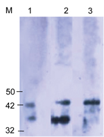 Thumbnail of Western blot analysis using the Orientia spp.–specific antigen (Otr47b). Twenty scrub typhus reactive serum samples at a titer ≥1:6,000 were used. Negative controls were serum samples that were reactive to spotted fever and typhus group antigens. The scrub typhus reactive serum samples recognized the Otr47b antigen (lanes 2 and 3), but the spotted fever group and typhus group reactive serum samples did not (data not shown). Lane 1 was probed with a positive control serum sample from