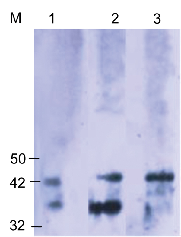 Western blot analysis using the Orientia spp.–specific antigen (Otr47b). Twenty scrub typhus reactive serum samples at a titer ≥1:6,000 were used. Negative controls were serum samples that were reactive to spotted fever and typhus group antigens. The scrub typhus reactive serum samples recognized the Otr47b antigen (lanes 2 and 3), but the spotted fever group and typhus group reactive serum samples did not (data not shown). Lane 1 was probed with a positive control serum sample from an earlier s
