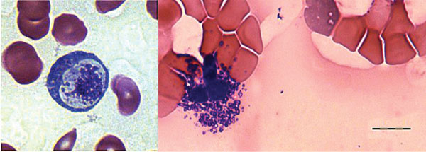 Giemsa-stained blood smear from an immunocompetent patient with Candidatus Neoehrlichia infection, Austria, 2013. The blood smear shows possible microbial pathogens within leukocytes. Scale bar indicates 10 μm.