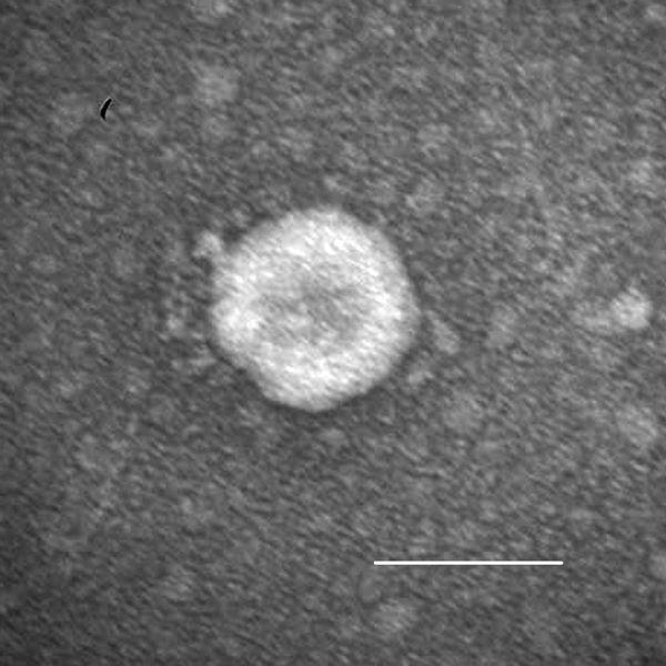 Porcine deltacoronavirus (OH-FD22) particle detected in intestinal contents from a gnotobiotic pig. The sample was negatively stained with 3% phosphotungstic acid. Scale bar = 100 nm.