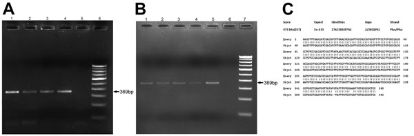 Real-time PCR amplification of ocular granuloma DNA obtained from patients infected with trematodes, South India. Gel electrophoresis was performed on 2% agarose gel by using Power SYBR Green Real-Time PCR (Applied Biosystems, Warrington, UK). A) Lanes 1–4 show subconjunctival granuloma DNA; lane 5, negative control; lane 6, 100-bp DNA marker. Arrow indicates 369-bp amplified DNA product. B) Lanes 1–5 show anterior chamber granuloma DNA; lane 6, negative control; lane 7, 100-bp DNA marker. Arrow